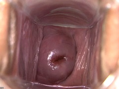 Tyttö, Fetissi, Gynekologi